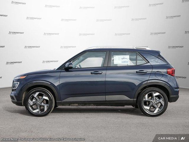 2025 Hyundai Venue Ultimate in Cars & Trucks in Calgary - Image 3