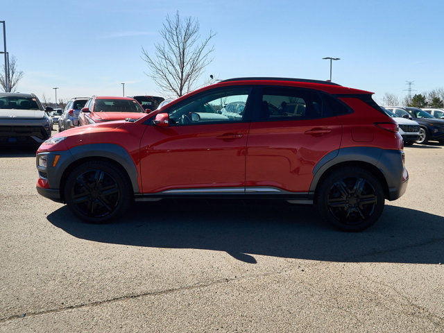 2020 Hyundai Kona Ultimate | AWD | SUNROOF | HEADS-UP DISPLAY in Cars & Trucks in Edmonton - Image 2