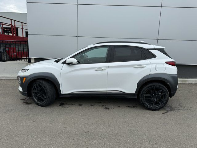 2021 Hyundai Kona Ultimate in Cars & Trucks in St. Albert - Image 2