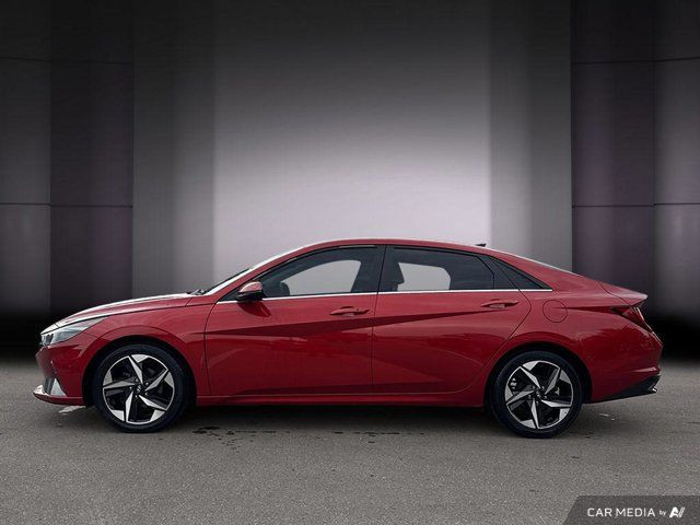 2021 Hyundai Elantra Ultimate| Leather | Navigation | Advanced in Cars & Trucks in Cambridge - Image 2