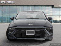 *Why choose 401 Dixie Hyundai for your next Hyundai?* Forget the trip to multiple Hyundai stores in... (image 1)