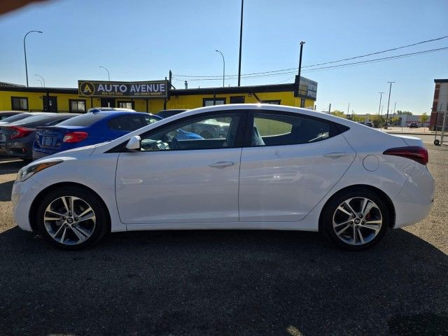2016 Hyundai Elantra Sport Appearance - HEATED SEATS, BACKUP CAM in Cars & Trucks in Calgary - Image 2