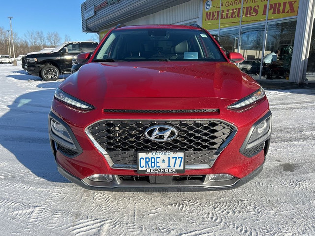 2020 Hyundai Kona Ultimate in Cars & Trucks in Ottawa - Image 2