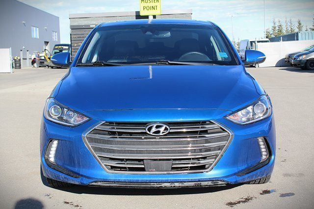 2017 Hyundai Elantra Limited Ultimate in Cars & Trucks in Calgary - Image 3