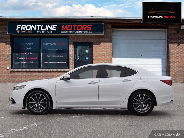 2015 Acura TLX 4dr Sdn SH-AWD V6 Tech in Cars & Trucks in City of Toronto - Image 3