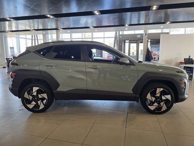 2025 Hyundai KONA Preferred Sport in Cars & Trucks in Calgary - Image 3