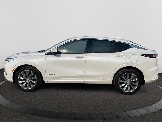 2025 Buick Envista Avenir in Cars & Trucks in Regina - Image 2