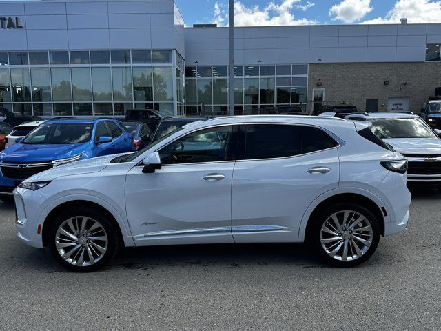2025 Buick Envision Avenir in Cars & Trucks in Calgary - Image 3