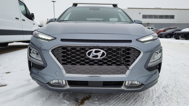 2020 Hyundai Kona 1.6T Ultimate AWD | 3M | LEATHER | PARK ASSIST in Cars & Trucks in Edmonton - Image 3