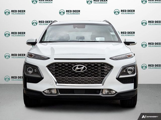 2021 Hyundai Kona Ultimate in Cars & Trucks in Red Deer - Image 3