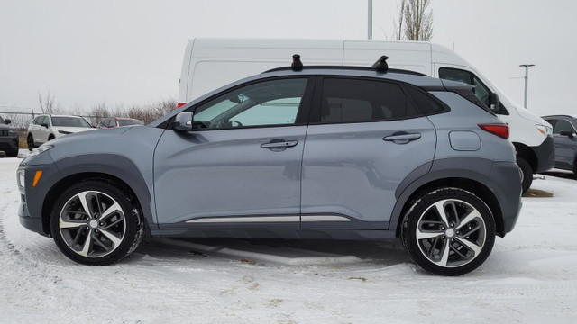 2020 Hyundai Kona 1.6T Ultimate AWD | 3M | LEATHER | PARK ASSIST in Cars & Trucks in Edmonton - Image 2