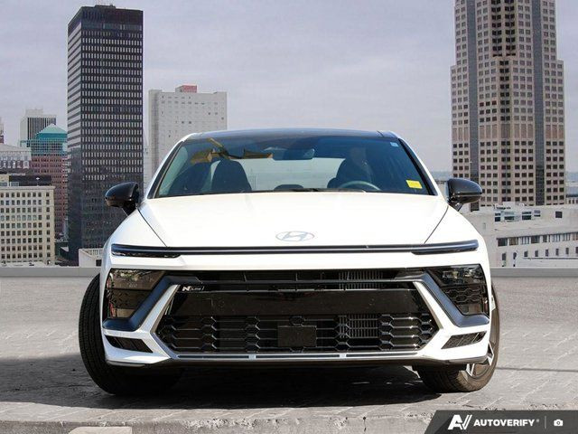 2025 Hyundai Sonata N Line Ultimate| No Accidents | LowKM in Cars & Trucks in Calgary - Image 2