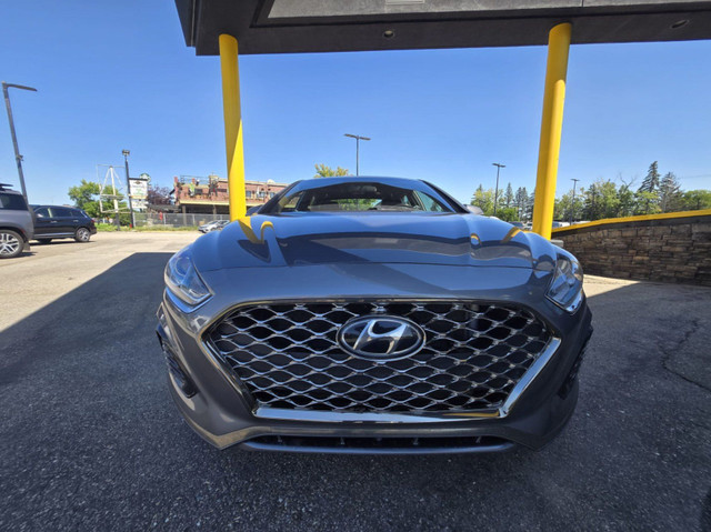 2018 Hyundai Sonata 2.4L Sport- Leather- Sunroof- Apple Carplay/ in Cars & Trucks in Calgary - Image 2