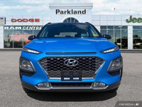 KBB.com 10 Coolest New Cars Under $20,000. This Hyundai Kona delivers a Intercooled Turbo Regular Un... (image 7)