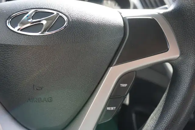 2017 Hyundai Veloster in Cars & Trucks in Oakville / Halton Region - Image 26