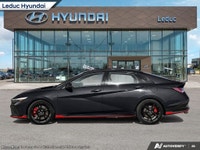 AMVIC LICENSED DEALER. PRICE EXPIRES May 21,2025 Engine: 2L TURBO 4cyl. L/100Km City: 11.0 L/100Km H... (image 2)