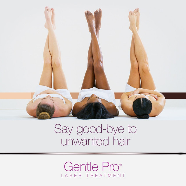 Laser hair removal - Hot Deals - Goodbye unwanted hair in Health and Beauty Services in Ottawa - Image 3