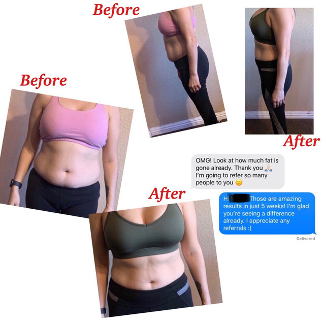 Bodysculpting - Freeze Fat 1/2 PRICE - FULL BODY SALE - AFTERPAY in Health and Beauty Services in Mississauga / Peel Region - Image 4