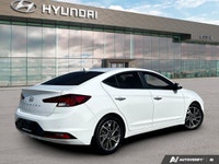 ===== Quality Used Cars in Mississauga – One Price. No Hassle. No Haggle. ===== At 401 Dixie Hyundai... (image 4)