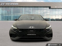 ===== Quality Used Cars in Mississauga – One Price. No Hassle. No Haggle. ===== At 401 Dixie Hyundai... (image 7)