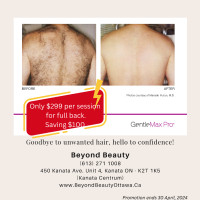 Laser hair removal - Hot Deals - Goodbye unwanted hair