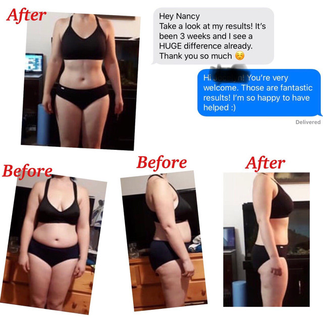 Bodysculpting - Freeze Fat 1/2 PRICE - FULL BODY SALE - AFTERPAY in Health and Beauty Services in Mississauga / Peel Region - Image 2