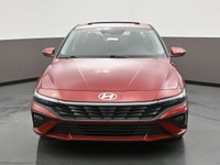 2025 HYUNDAI ELANTRA PREFERRED WITH TECH PACKAGE â€¢ CLEAN CARFAX â€” NO REPORTED ACCIDENTS OR DAMAG... (image 1)
