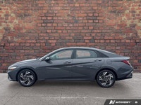 Check out this 2025 Hyundai Elantra Preferred while we still have it in stock! *You Can't Beat the P... (image 1)
