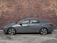 Check out this 2025 Hyundai Elantra Preferred while we still have it in stock! *You Can't Beat the P... (image 1)