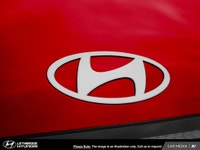 Discover the joy of a seamless car-buying experience at Lethbridge Hyundai. We offer a warm and invi... (image 8)