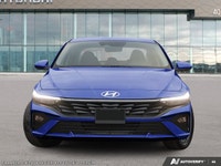 *Why choose 401 Dixie Hyundai for your next Hyundai?* Forget the trip to multiple Hyundai stores in... (image 1)