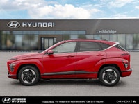 Discover the joy of a seamless car-buying experience at Lethbridge Hyundai. We offer a warm and invi... (image 2)