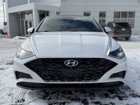 Crowfoot Hyundai, AMVIC Licensed Dealer Mileage: 103,087km History: No Accidents, One Owner Experien... (image 1)