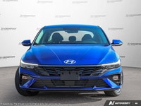 Crowfoot Hyundai, AMVIC Licensed Dealer Mileage: 9,239 km History: No accidents Experience the perfe... (image 1)