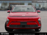 Discover the joy of a seamless car-buying experience at Lethbridge Hyundai. We offer a warm and invi... (image 1)