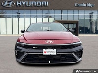 The *2025 Hyundai Elantra N Line Ultimate* is the perfect middle ground for the driver who wants gen... (image 7)