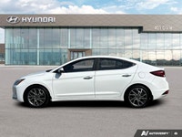 ===== Quality Used Cars in Mississauga – One Price. No Hassle. No Haggle. ===== At 401 Dixie Hyundai... (image 1)