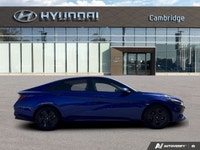 *2023 Hyundai Elantra Preferred | Heated Seats | Heated Steering | CarPlay | Safety Suite* *Turn hea... (image 5)