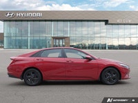 Come be a part of the 401 Dixie Hyundai Used Vehicle Experience! We have one of the largest selectio... (image 5)