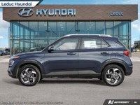 AMVIC LICENSED DEALER. PRICE EXPIRES May 21,2025 Engine: 1.6L 4cyl. L/100Km City: 7.9 L/100Km Hwy: 6... (image 2)