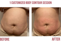 Customized body contouring sessions for fat loss 