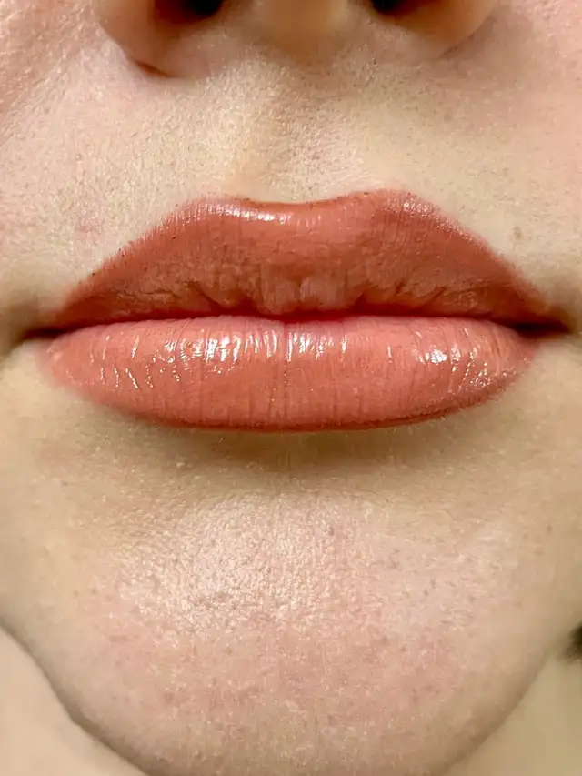 PROMOTION FOR BOTOX 4.5$ per unit Filler 270$ MOBILE SERVICE GTA63235385774849121