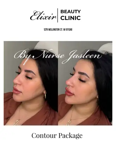 Thermage, Sciton BBL, Potenza, Hydrafacial, Botox, HA Filler, View more