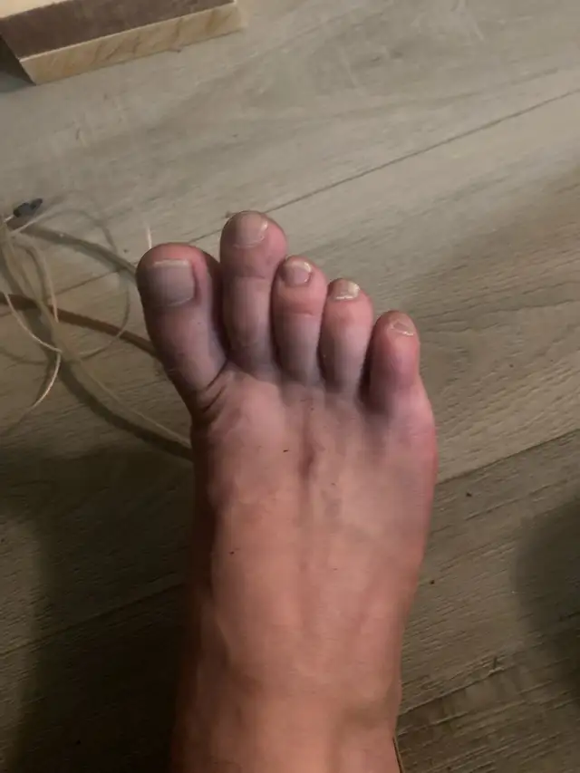 nurses she took my 70 girlfriend