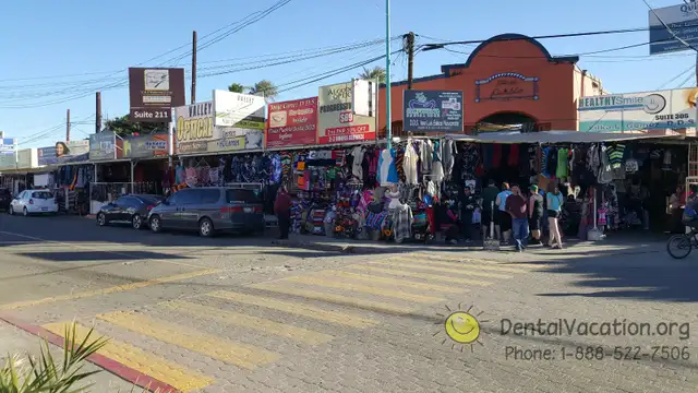 Budget Dental Services in Los Algodones