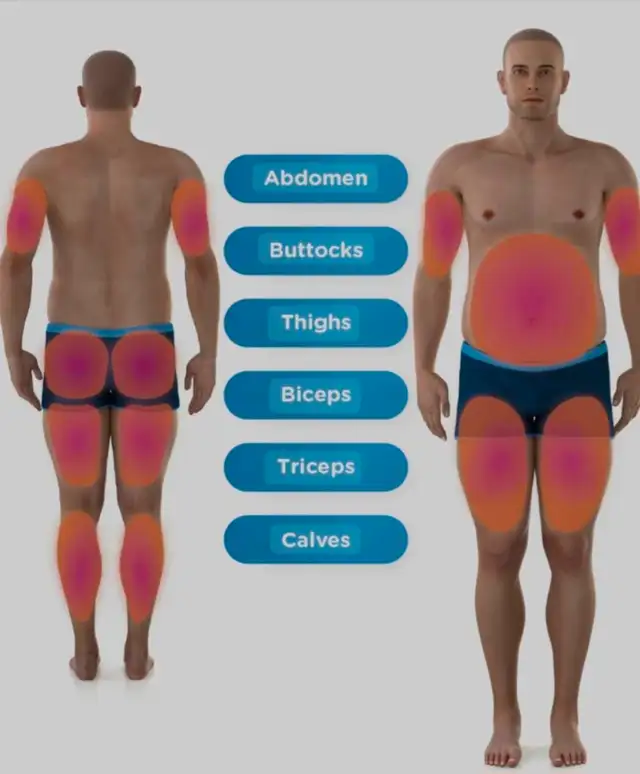 $100 EMSCULPT TREATMENT FOR SUMMER TIME TONED BODY 62863723457409124