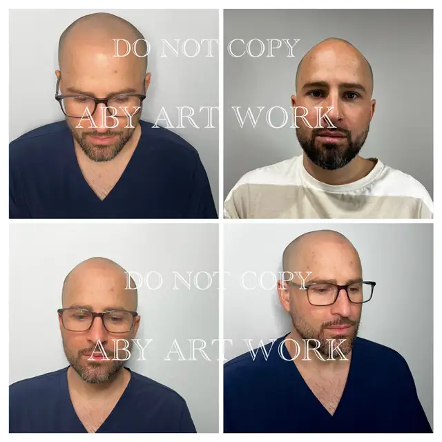 Thin Hair? Crown Issues? I Fix That-Mobile service.64551238985475122