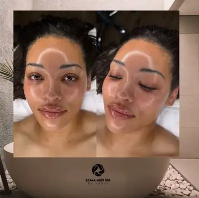 Reveal Your Glow – Facials & Skin Treatments in Etobicoke, View more