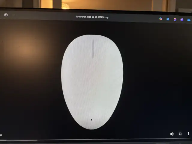 Smart Nora -  Snoring Solution64601014179203122