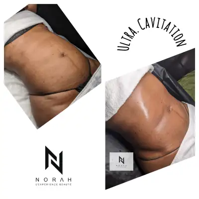 Cils/Facial/Lipocavitation ✨ Expérience Beauté VIP à Montréal –, View more